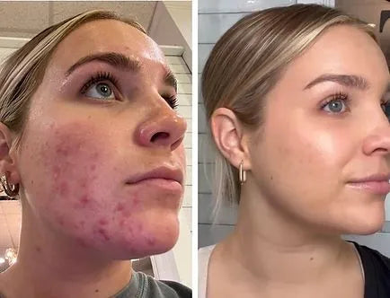 Bioaqua Peach Extract Fruit Acid Exfoliating Face Gel Cream 140g